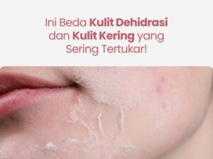 Ini Beda Kulit Dehidrasi dan Kulit Kering yang Sering Tertukar!