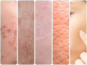 5 Penyebab Kulit Sulit Glowing!